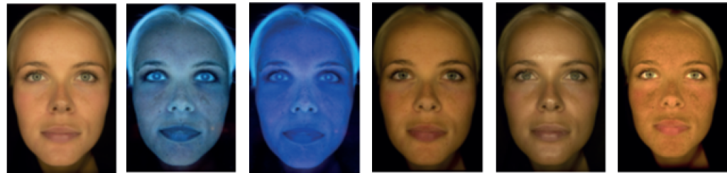 Voorbeeld van een huidanalyse met de Observ